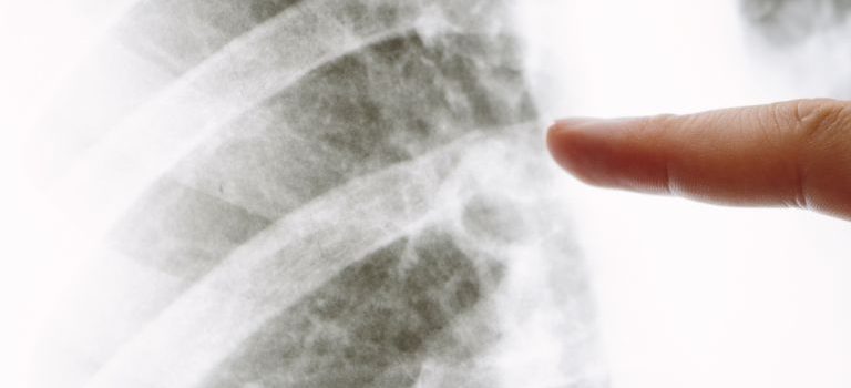 ワイヤー矯正と他手法徹底比較理想の口元をつくる歯科矯正の魅力 ワイヤー矯正と他手法徹底比較理想の口元をつくる歯科矯正の魅力